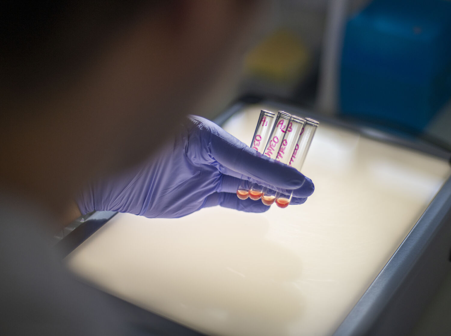 Laboratoire qualification biologique des dons Angers - Ressources bio