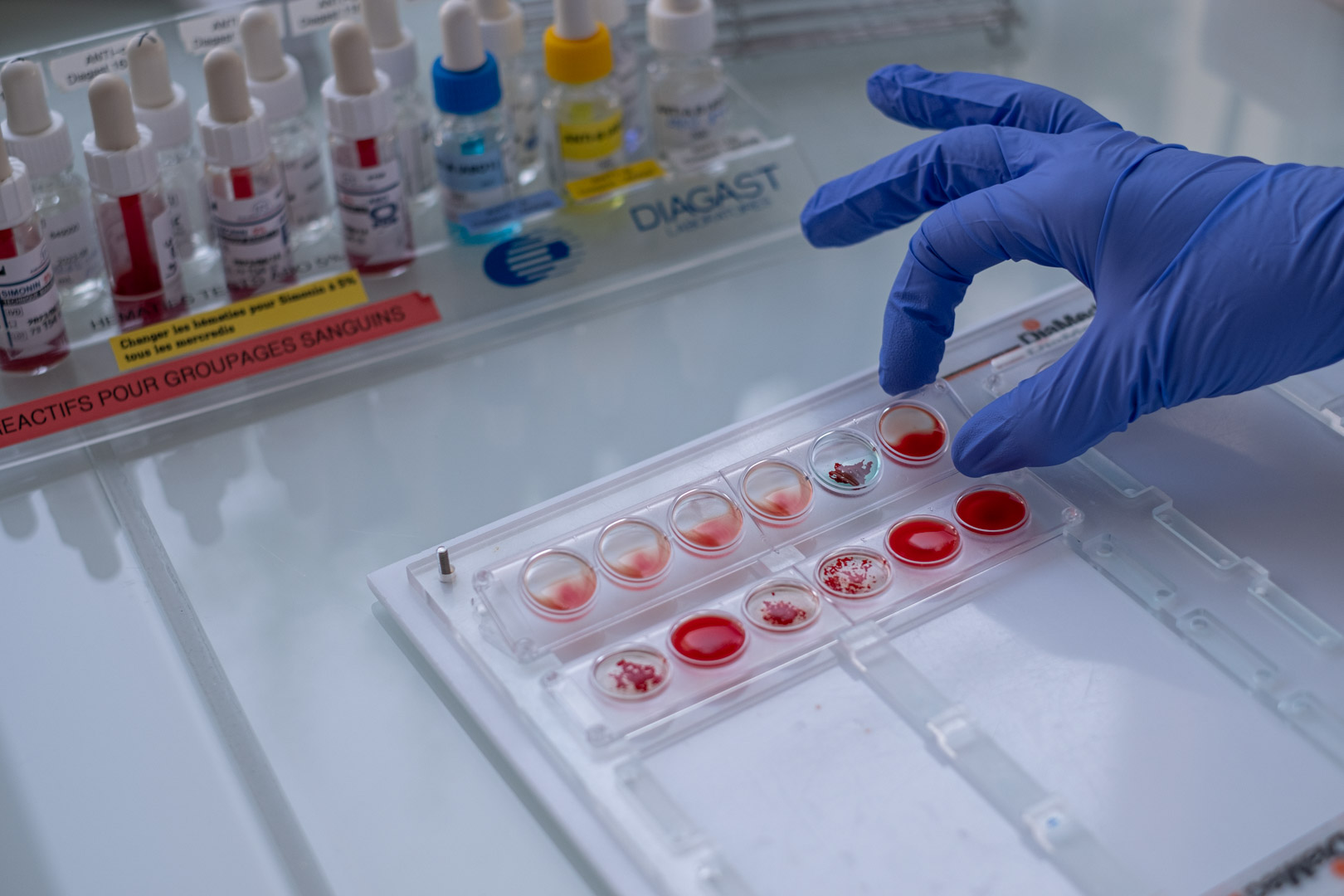 Immuno-hématologie érythrocytaire - Bretagne