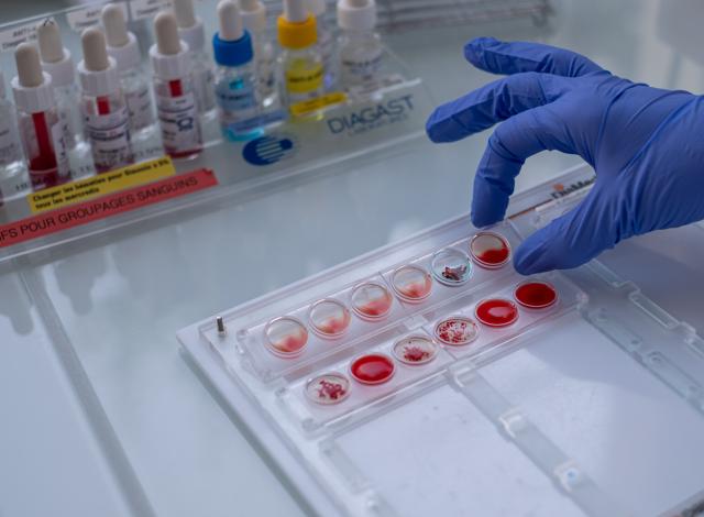 IHE - Bretagne Immuno-hématologie érythrocytaire - Bretagne