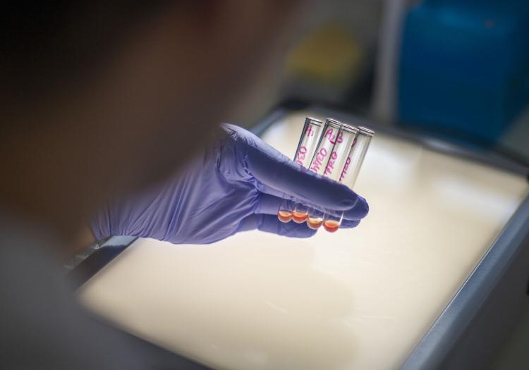 Laboratoire qualification biologique des dons Angers - Ressources bio Laboratoire qualification biologique des dons Angers - Ressources bio