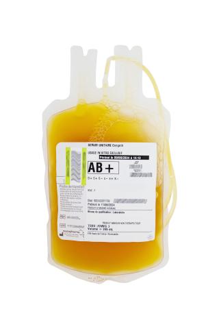 Sérum AB -8190_© EFS Tasky Orane