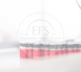 Red Adsorp 14